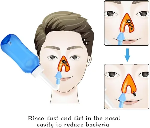 Vista 3 de Darate Neti Pot - Botella de enjuague sinusal, limpiador de lavado de nariz, enjuague a presión, riego nasal para adultos y niños, sin bisfenol A