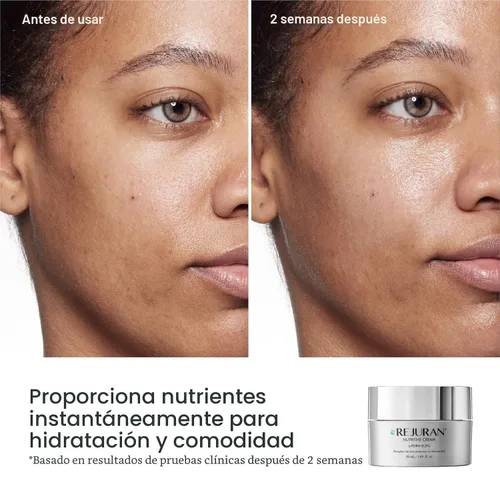 Vista 4 de REJURAN® Crema nutritiva, c-PDRN® - Crema hidratante facial de ADN de salmón para nutrir, hidratar profundamente. Logra una piel de vidrio radiante