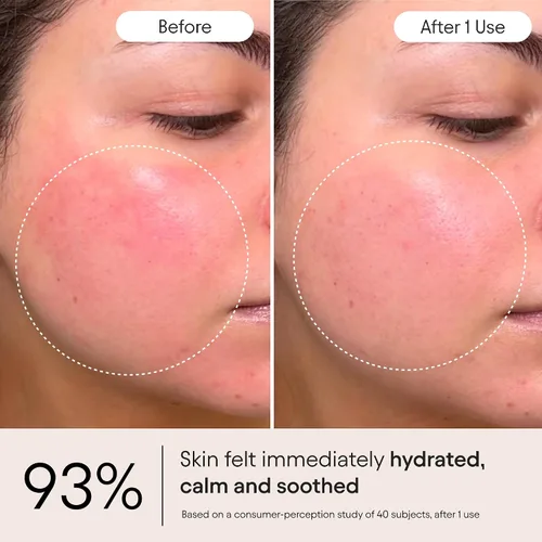 Vista 4 de Alpyn Super Peptide & Ghostberry Hidratante para reparación de eczema, barrera y arrugas Calma y calma contra el enrojecimiento y la irritación