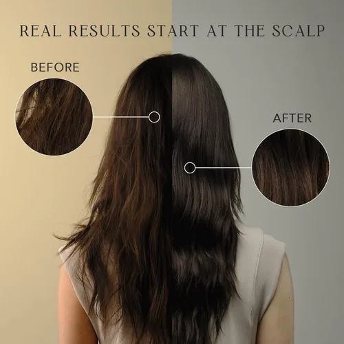 Vista 5 de KIWABI ROOT BEAUTÉ - Acondicionador para el cuero cabelludo – Tratamiento para el crecimiento del cabello y el cuero cabelludo para adelgazamiento