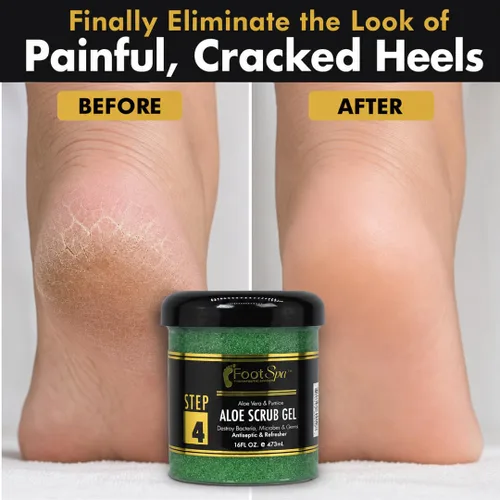 Vista 6 de FOOT SPA Exfoliating Scrub Gel – Piedra pómez y ácido salicílico removedor de callos de doble acción para talones agrietados, pies secos y manos