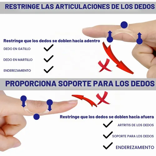 Vista 3 de 10 piezas de kit de férulas y mangas de dedo ovaladas transparentes, 6 férulas graduadas para dedo gatillo y 4 mangas de dedo para dedo