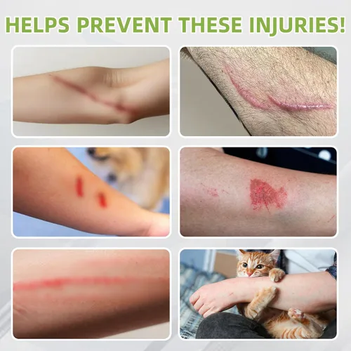 Vista 6 de Schwer Mangas de brazo resistentes a pinchazos ANSI A9 de 9 pulgadas