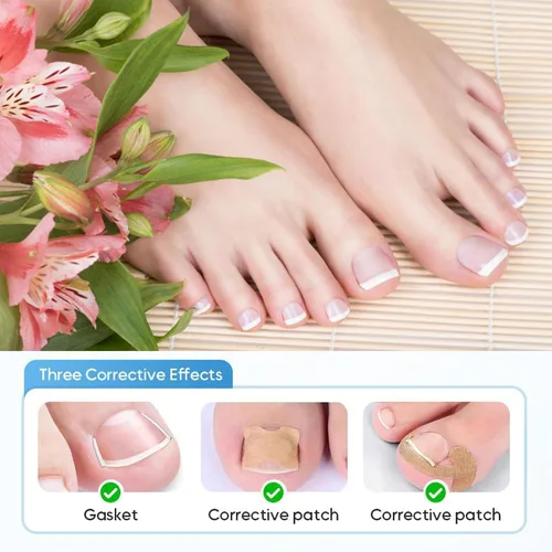 Vista 2 de Juego profesional de uñas encarnadas con tiras transpirables de uñas encarnadas, tiras correctoras de uñas de los pies, parche corrector de uñas