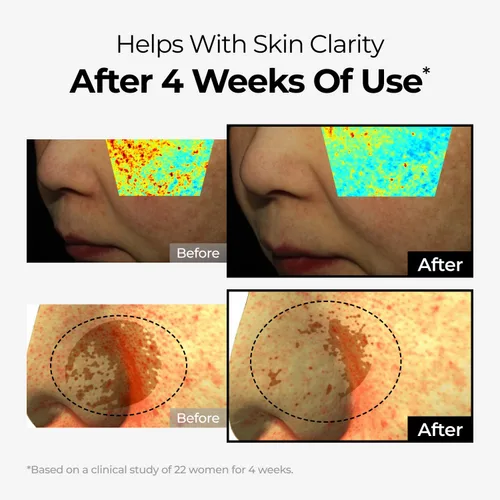 Vista 12 de DOMINAS Crema correctora de manchas oscuras Fórmula avanzada con niacinamida, TXA, hexilresorcinol y bakuchiol para reducir visiblemente
