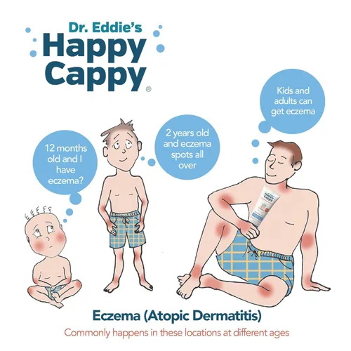 Vista 6 de Happy Cappy Champú para bebés y gel de baño - Champú y gel de baño para piel propensa al eczema, para bebés, niños pequeños y niños, reduce