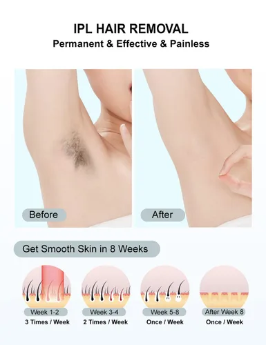 Vista 2 de Depilación láser IPL para mujeres y hombres, depiladora facial permanente en casa, depiladora facial 999,999 parpadeos, removedor de vello sin dolor