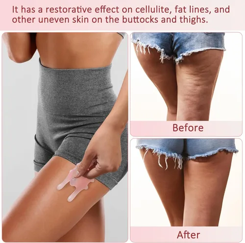 Vista 3 de AICNLY Herramienta de masaje grande para la celulitis, rodillo de celulitis de tejido profundo para drenaje linfático, impulso de circulación