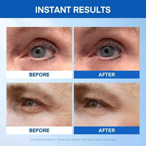 Vista 5 de Suero instantáneo para levantar debajo de los ojos: reduce las bolsas de ojos, arrugas, ojos hinchados, ojeras y patas de gallo en cuestión