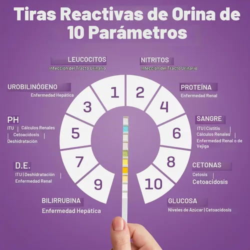 Vista 3 de One Step Tiras de prueba de orina para mascotas, tiras de prueba de análisis de orina de 5 x 10 parámetros, tiras de prueba de pH de orina