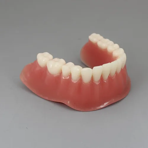 Vista 6 de Color dorado dental del diente inferior de la sobredentadura del implante de la precisión 4 modelo de los dientes