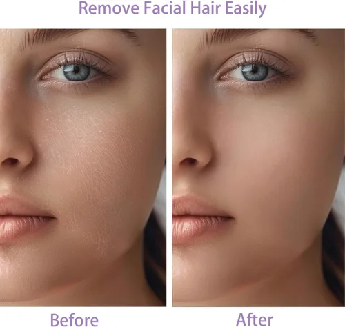 Vista 3 de Dispositivo de Eliminación de Vello Facial para Mujeres, Operado con Batería y con 2 Cabezales de Repuesto, Afeitadora Facial Indolora para Mujeres