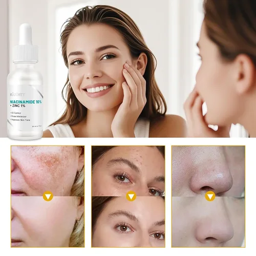 Vista 4 de Suero de niacinamida 10% + zinc 1% para mujeres, suero de niacinamida para cara, controla el aceite, encoge los poros, reduce el enrojecimiento
