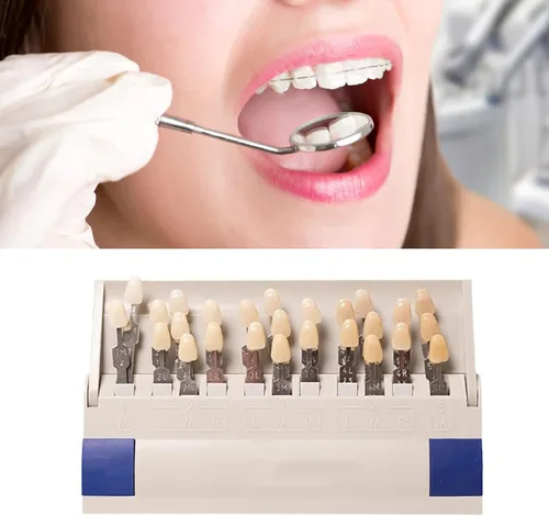 Vista 2 de ZJchao Sombra de dientes, sombra de dientes, 29 colores extraíbles, tabla de sombra para blanquear los dientes