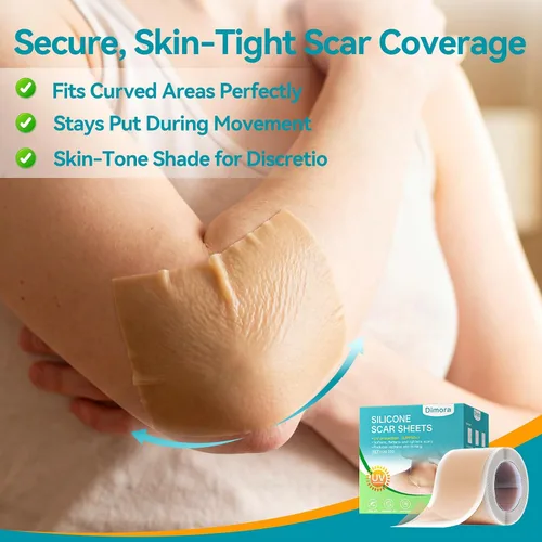 Vista 6 de Dimora UPF50+ - Hojas de silicona para cicatrices con protección UV, rollo de 1.6 x 78.7 pulgadas Protección UV, reutilizable, suaviza, aplana