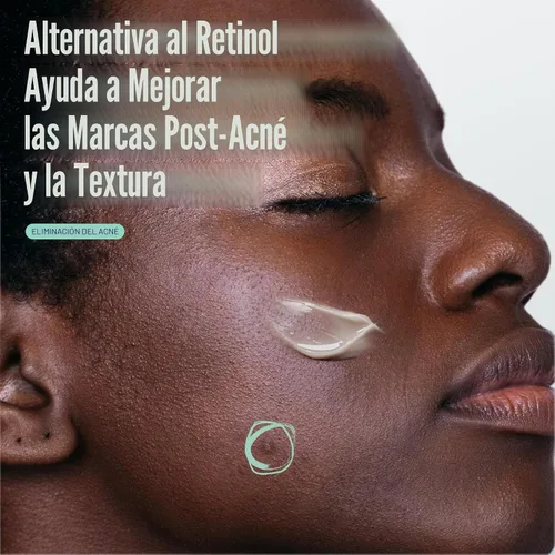 Vista 3 de CETAPHIL Suero Reparador Suave y Claro Post-Acné, Alternativa al Retinol, Suero Sin Aceite para Piel Sensible, 1 Onza Líquida, Bakuchiol, Mejora