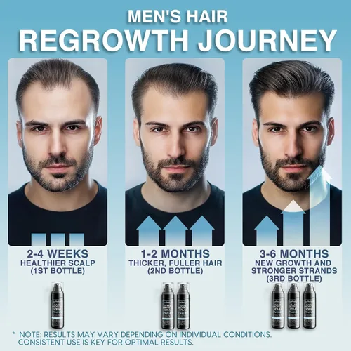 Vista 5 de Suero natural para el crecimiento del cabello para hombres: aceite para el cabello y el cuero cabelludo con romero, aceite de batana, agua de arroz