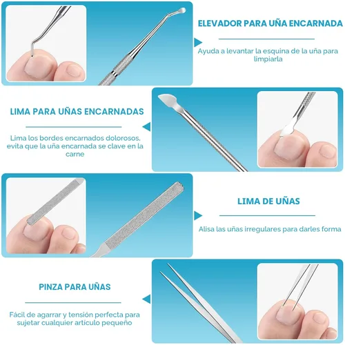 Vista 5 de Kit Profesional para Retirar Uñas Encarnadas, Incluye Gotas Correctoras de Uñas Encarnadas, Parche Corrector, Cortauñas, Lima de Uñas, Herramientas