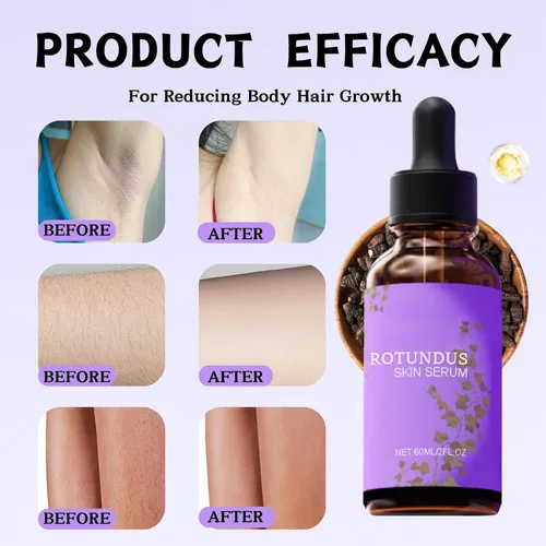 Vista 3 de 2 sueros para piel Rotundus, aceite Rotundus, esencia reparadora de depilación, aceite corporal hidratante natural, calmante y suave, adecuado