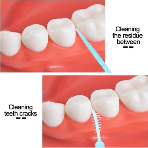 Vista 3 de FOMIYES Palillos de dientes de doble cabeza, 1060 palillos de dientes desechables para limpieza de dientes, palillos de hilo dental suave, palillos