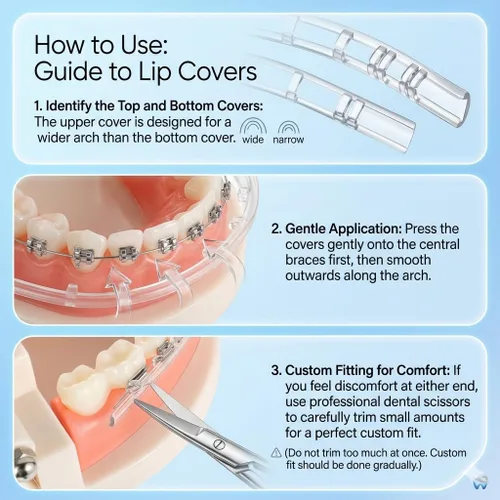 Vista 2 de Fundas cómodas para aparatos ortopédicos, protector bucal de ortodoncia, protector de labios, alternativa a la cera, protector labial para soportes