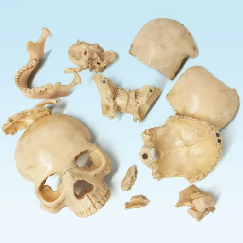 Vista 3 de EVOTECH SCIENTIFIC Mini modelo de calavera humana, 15 piezas didácticas modelo de calavera de anatomía explosionada del tamaño de la palma
