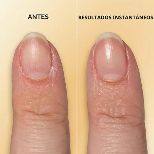 Vista 5 de Sally Hansen Bolígrafo de tratamiento de uñas y cutículas con vitamina E Hidrata y acondiciona las uñas secas Fórmula nutritiva con aceite