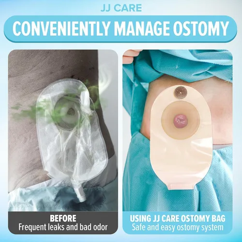 Vista 8 de Bolsas de colostomía 20 piezas, bolsas de ostomía de una pieza, suministro de ostomía sin desorden