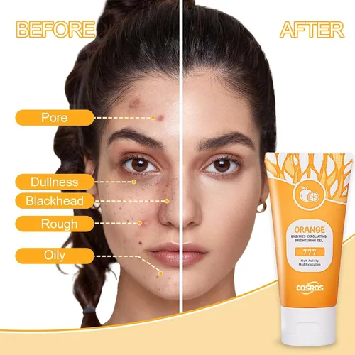 Vista 7 de Gel exfoliante FAIRYTALESPACE de naranja para rostro y cuerpo, gel de peeling de naranja, limpieza profunda de los poros, quita puntos negros