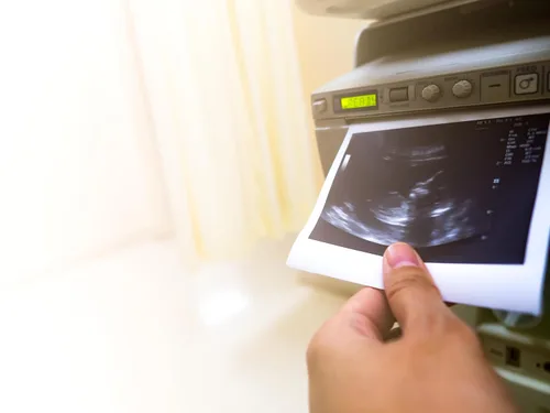 Vista 3 de Papel de impresión UPP-110HD de alta densidad - Caja de 10 rollos