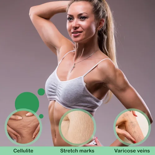 Vista 4 de Reshape+ Gel anticelulítico para tensar la piel, crema reafirmante para estrías, 8 onzas líquidas (paquete de 2)