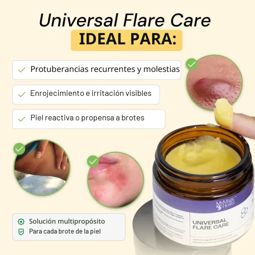 Vista 2 de MyMagicHealer Universal Flare Care Pomada Extractora para HS, forúnculos, quistes, hemorroides, quiste pilonidal, absceso Anti-rozaduras
