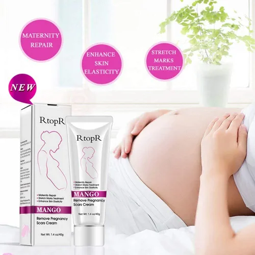 Vista 4 de RtopR Mango Crema para estrías y cicatrices - Crema para estrías y eliminación de cicatrices para el embarazo, la mejor crema hidratante corporal