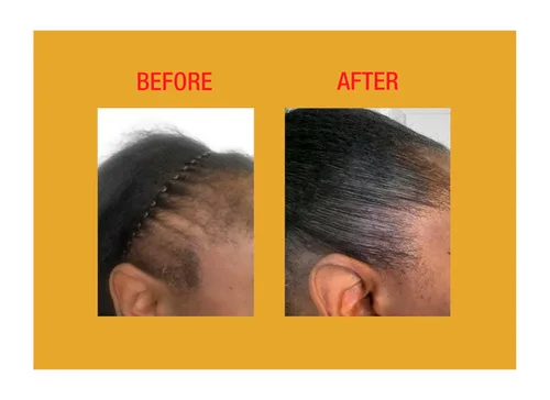 Vista 5 de GOOD2GRO - Acondicionador de crecimiento y engrosamiento de biotina, 8 onzas, fortalece y repara el adelgazamiento del cabello, reduce la rotura
