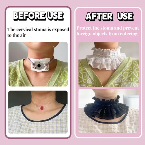 Vista 3 de 2 fundas de traqueotomía de encaje para mujer, protector de estoma de cuello blanco y negro, transpirable, de algodón suave, protector de estoma