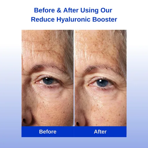 Vista 4 de Michael Marcus Reduce Hyaluronic Booster Plus – Suero facial para reducir líneas finas y arrugas – Suero facial hidratante para mujeres y hombres
