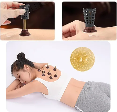 Vista 7 de Aiaijiu - Juego de palos de moxa autoadhesivos, kit de moxibustión de medicina tradicional china con soportes de base, tapas protectoras, ideal