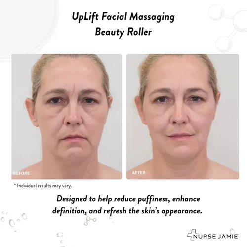 Vista 6 de Nurse Jamie Rodillo de belleza para masaje facial Uplift - Edición navideña