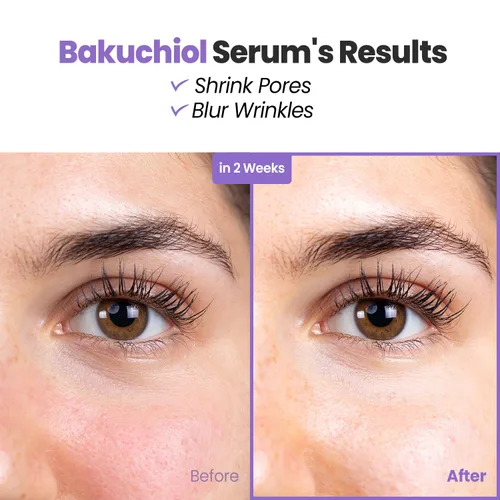 Vista 2 de Glam Up Suero Bakuchiol y ácido hialurónico – Suero alternativo al retinol antienvejecimiento, líneas finas difuminadas, antiarrugas, encogimiento