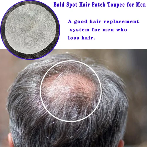 Vista 5 de Voloria Parche para el cabello calvo para hombres, 3.15 x 3.15 pulgadas, sistema de reemplazo de cobertura completa de piel de poliuretano
