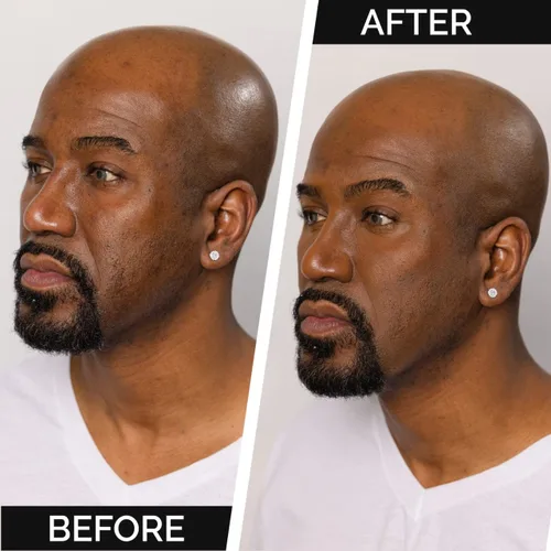 Vista 8 de Mænaji - Eliminador de brillo líquido en polvo Polvo antibrillo para hombres Eliminador de aceite facial Suaviza líneas finas y arrugas