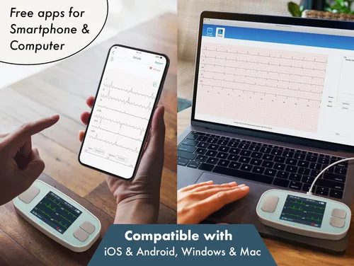 Vista 8 de EMAY 6L Monitor ECG portátil Graba ECG y frecuencia cardíaca en 6 canales Compatible con Smartphone y PC No se requiere suscripción