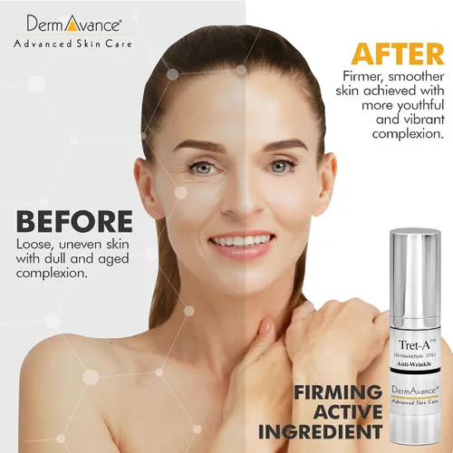 Vista 5 de DermAvance Tret-A Retinaldehído 0.15% más fuerte Anti-envejecimiento Crema facial Rutina para mujeres - Crema hidratante facial antienvejecimiento