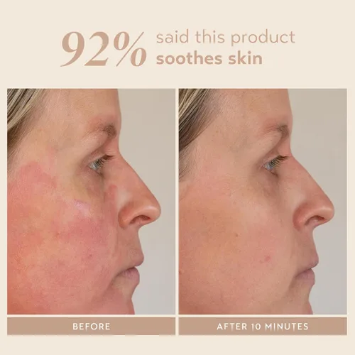 Vista 6 de SHANI DARDEN SKIN CARE Signature - Mascarilla facial nutritiva de arcilla de bentonita para calmar el enrojecimiento e irritación de la cara