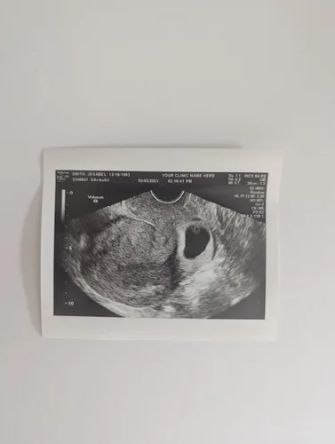 Vista 4 de Broma de ultrasonido falso personalizado 2D, foto única SOLO, SIN género