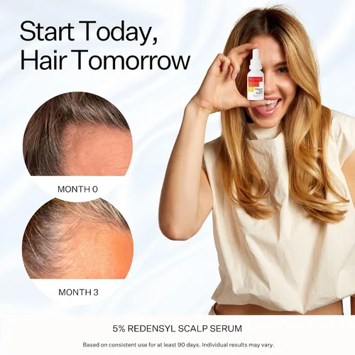 Vista 3 de Scalp Delivery Suero vegano para el crecimiento del cabello al 5% – Productos para el crecimiento del cabello para hombres y mujeres ayudan a