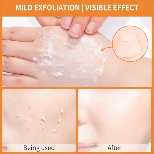 Vista 4 de Gel exfoliante naranja, gel exfoliante de enzima naranja para cara y cuerpo, estiramiento de la piel y reducción de puntos negros, exfoliante