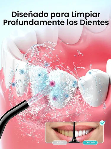 Vista 2 de COSLUS Irrigador de Agua Portátil para Dientes: 10 Ajustes de Presión Profesional para Ortodoncia, Aparejos y Encías Sensibles - Inalámbrico
