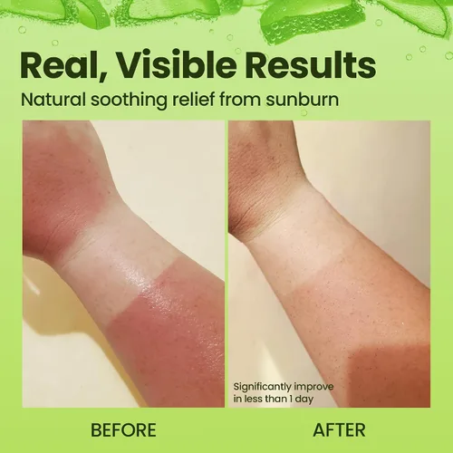 Vista 5 de Gel orgánico de Aloe Vera: gel 100% puro de Aloe con miel de Manuka. Cuidado facial y del cuerpo después del sol. Gel de hoja de Aloe