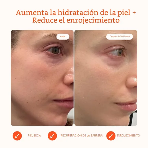 Vista 2 de Tower 28 SOS Recovery - Crema facial hidratante facial con ácido hialurónico + ceramidas, humectante reparador de barrera cutánea, reduce